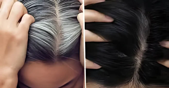 home remedies for white hair